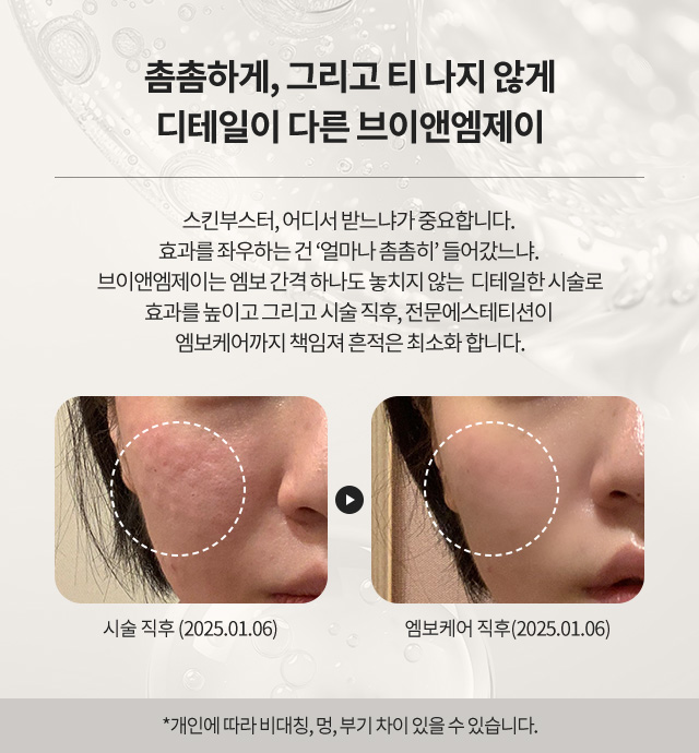 커스텀스킨부스터