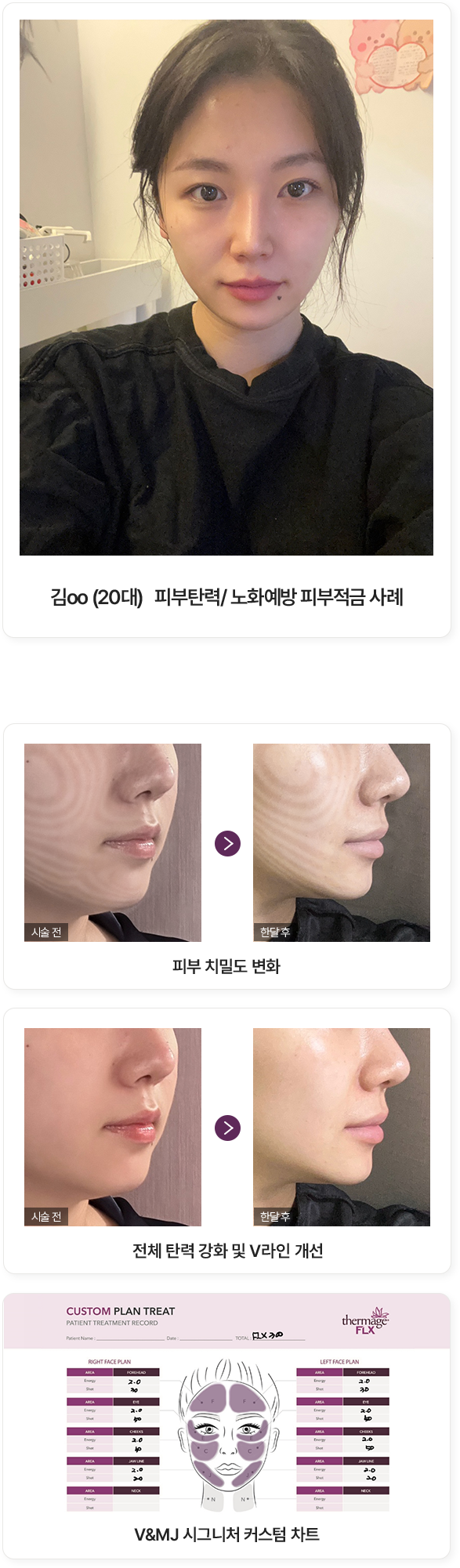 울쎄라, 커스텀울쎄라, 울쎄라시술, 울쎄라전문, 울쎄라리프팅, 울쎄라리프팅시술