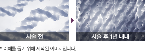 홈에스테틱,홈쎄라,압구정로데오피부과,가정용리프팅,갈바닉마사지기,강남튠페이스,홈케어디바이스,가정용미용기기,리프팅기기,슈링크유니버스