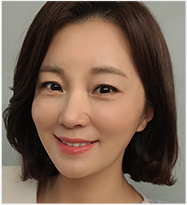 울쎄라전후,피부리프팅기기,얼굴리프팅,아이슈링크,슈링크리프팅,리프팅기구,홈케어슈링크,홈케어리프팅,인모드레이저,피부마사지기