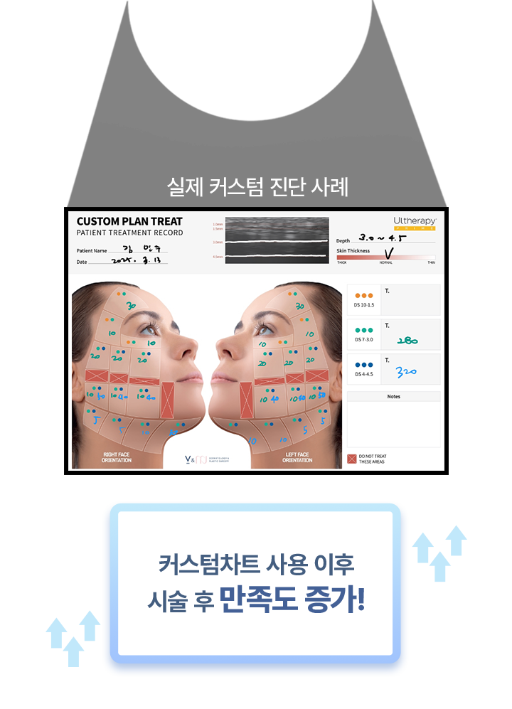 강남울쎄라,울쎄라피부과,울쎄라수면마취,울쎄라잘하는곳,압구정울쎄라,써마지울쎄라,울쎄라300샷,울써마지가격,아이써마지가격,아이써마지