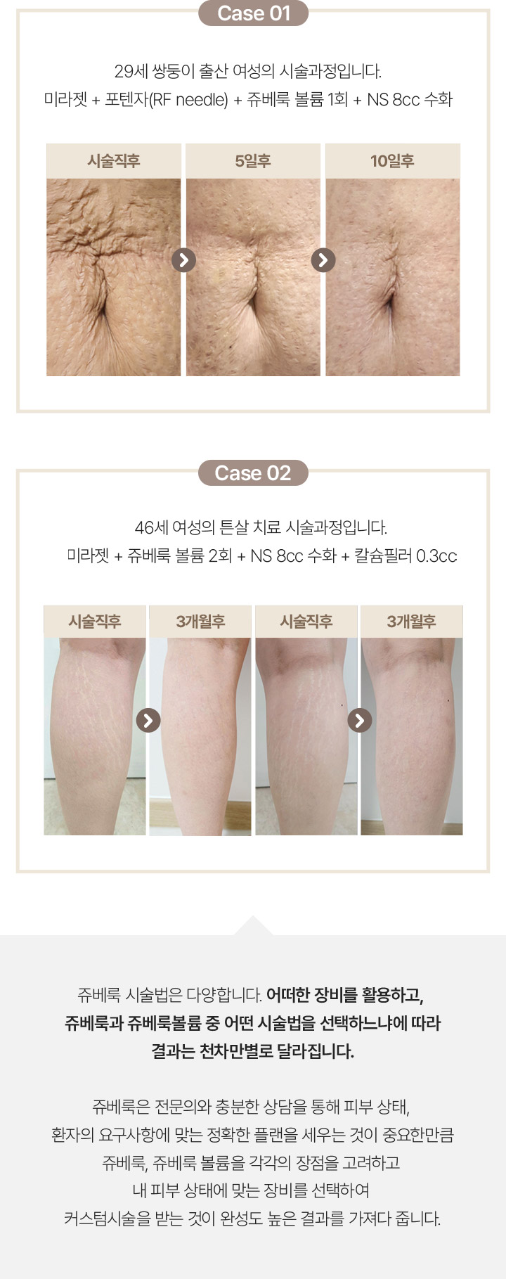 포텐자모공,스컬트라필러,안티에이징,워터핏,베네브,강남구청역성형외과,셀라스프락셀,쥬베룩결절,쥬베룩리쥬란,쥬베룩모공,물광주사,포텐자피부과,튼살치료,튼살