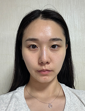 홈에스테틱,홈쎄라,압구정로데오피부과,가정용리프팅,갈바닉마사지기,강남튠페이스,홈케어디바이스,가정용미용기기,리프팅기기,슈링크유니버스