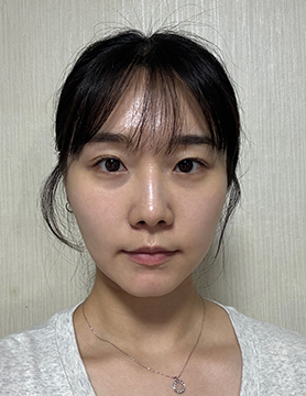 홈에스테틱,홈쎄라,압구정로데오피부과,가정용리프팅,갈바닉마사지기,강남튠페이스,홈케어디바이스,가정용미용기기,리프팅기기,슈링크유니버스