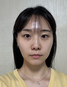 홈에스테틱,홈쎄라,압구정로데오피부과,가정용리프팅,갈바닉마사지기,강남튠페이스,홈케어디바이스,가정용미용기기,리프팅기기,슈링크유니버스