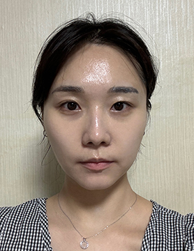 홈에스테틱,홈쎄라,압구정로데오피부과,가정용리프팅,갈바닉마사지기,강남튠페이스,홈케어디바이스,가정용미용기기,리프팅기기,슈링크유니버스