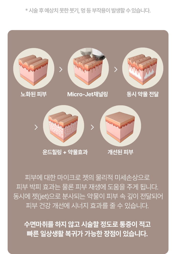 울쎄라전후,피부리프팅기기,얼굴리프팅,아이슈링크,슈링크리프팅,리프팅기구,홈케어슈링크,홈케어리프팅,인모드레이저,피부마사지기