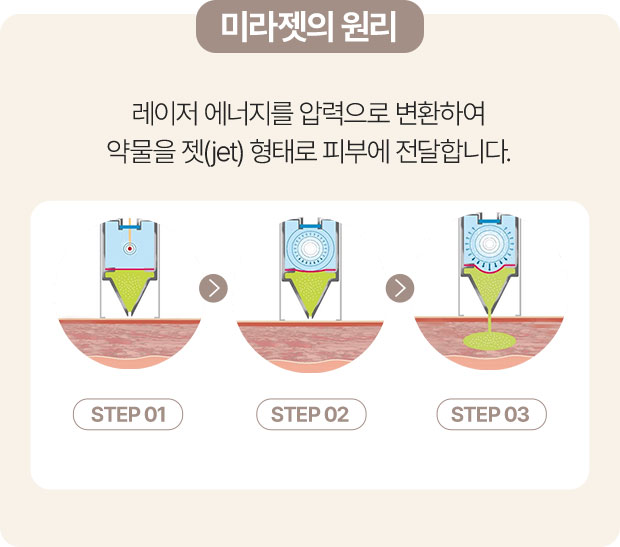 3D엑소좀,볼빛주사,레니스나,엑소좀포텐자,포텐자엑소좀,미라젯스킨부스터,포텐자쥬베룩,홍대쥬베룩,울쎄라토스,아토스레이저,포텐자레이저,강남역쥬베룩,쥬베룩흉터,압구정쥬베룩