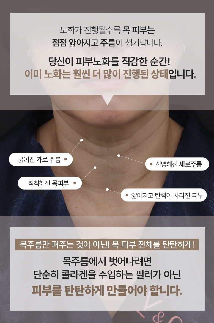 필러녹이기,필러,눈밑필러