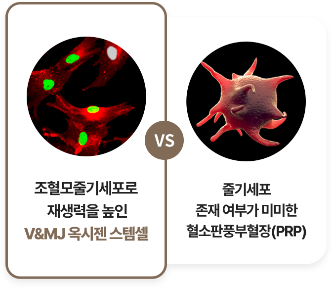 IBEX,고압산소,산소챔버,고압옥시젠 파워 스템셀기가격,옥시젠 파워 스템셀기,고압산소캡슐,산소방