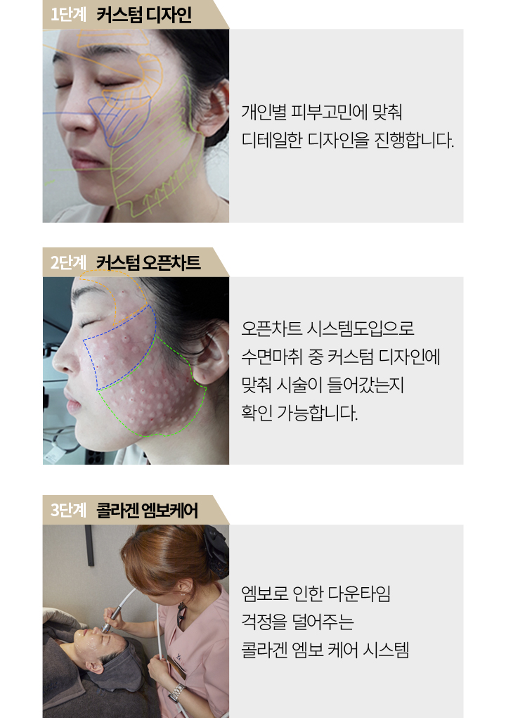 리쥬란힐러효과,스킨보톡스,리쥬메이트,리쥬란HB,쥬베룩,리쥬란HB플러스,리쥬란아이,리주란,리쥬란피부과