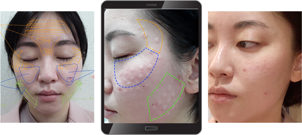 보톡스피부과,피부과보톡스,메디톡스보톡스,보톡스클리닉,대웅제약나보타,보톡스주사,관자놀이보톡스,보톡스병원추천,이마엘란쎄,얼굴보톡스,강남코어톡스,눈밑보톡스,BOTOX,물톡스,보톡스주의사항,인중보톡스,턱보톡스제오민,나보타제오민,리쥬란힐러,더모톡신,리쥬란,더마톡신,스킨부스터,스킨보톡스가격,리쥬란힐러가격,더마톡스,스킨보톡스비용