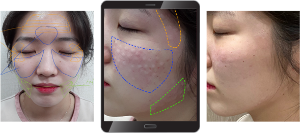 보톡스피부과,피부과보톡스,메디톡스보톡스,보톡스클리닉,대웅제약나보타,보톡스주사,관자놀이보톡스,보톡스병원추천,이마엘란쎄,얼굴보톡스,강남코어톡스,눈밑보톡스,BOTOX,물톡스,보톡스주의사항,인중보톡스,턱보톡스제오민,나보타제오민,리쥬란힐러,더모톡신,리쥬란,더마톡신,스킨부스터,스킨보톡스가격,리쥬란힐러가격,더마톡스,스킨보톡스비용