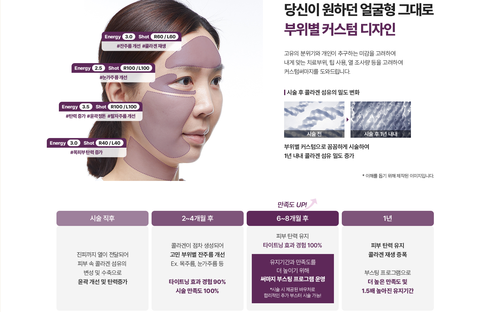 4세대써마지,바디써마지,써마지FLX600샷,수면써마지,써마지전문,울쎄라가격,써마지900샷가격,써마지시술,써마지후기,써마지추천,써마지900샷,아이바이써마지,써마지키닥터,신사동써마지,듀엣써마지,아이써마지이벤트,써마지병원,써마지잘하는곳,THERMAGE,써마지600샷